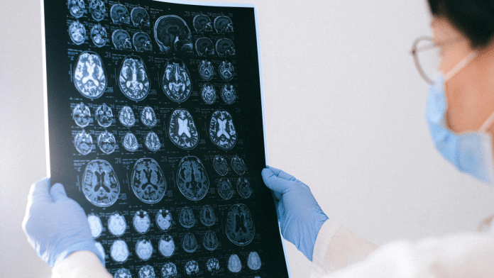 A ciência é clara: sofrimento prolongado altera o cérebro