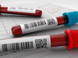 Médico alerta: exame de sangue simples prevê infarto em qualquer pessoa — e quase ninguém sabe disso