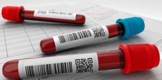 Médico alerta: exame de sangue simples prevê infarto em qualquer pessoa — e quase ninguém sabe disso Médico alerta: exame de sangue simples prevê infarto em qualquer pessoa — e quase ninguém sabe disso