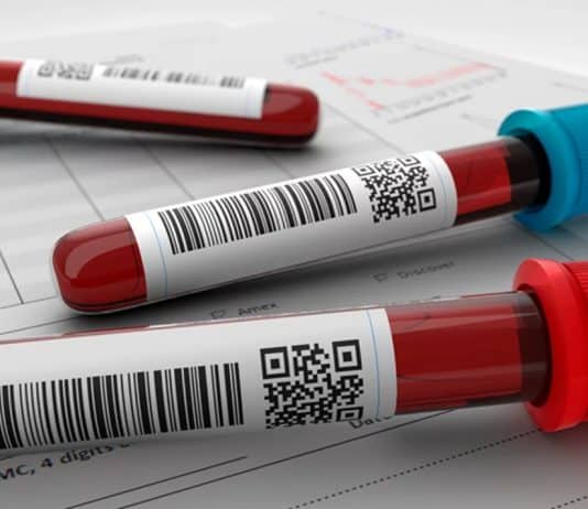 Médico alerta: exame de sangue simples prevê infarto em qualquer pessoa — e quase ninguém sabe disso