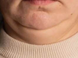 Pescoço grosso ou fino demais? O que isso diz sobre sua saúde vai te surpreender