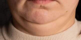 Pescoço grosso ou fino demais? O que isso diz sobre sua saúde vai te surpreender Pescoço grosso ou fino demais? O que isso diz sobre sua saúde vai te surpreender