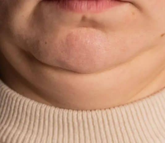 Pescoço grosso ou fino demais? O que isso diz sobre sua saúde vai te surpreender
