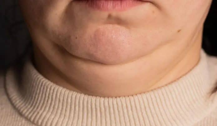 Pescoço grosso ou fino demais? O que isso diz sobre sua saúde vai te surpreender