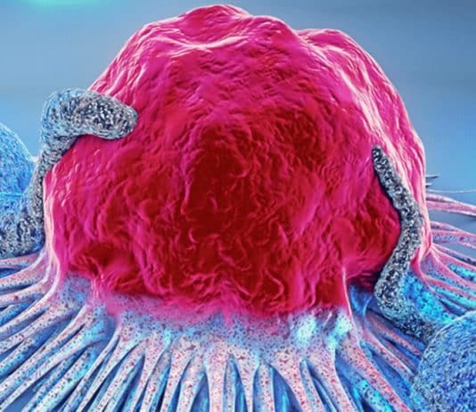 Do prato ao DNA: o que estes 8 alimentos têm a ver com prevenção do câncer