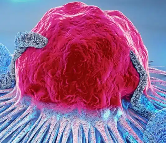 Do prato ao DNA: o que estes 8 alimentos têm a ver com prevenção do câncer Do prato ao DNA: o que estes 8 alimentos têm a ver com prevenção do câncer