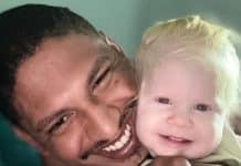 ‘Ela é de quem?’: pai negro expõe os comentários cruéis que ouve por ter filha albina Pai negro tem filha albina e revela comentários absurdos que já ouviu
