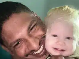 Pai negro tem filha albina e revela comentários absurdos que já ouviu