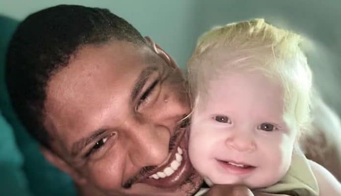 ‘Ela é de quem?’: pai negro expõe os comentários cruéis que ouve por ter filha albina