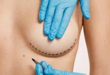 Menos cortes, menos cicatriz: Nova tecnologia cria implante injetável para reconstrução das mamas após mastectomia reconstrução das mamas nova tecnologia
