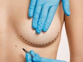 Menos cortes, menos cicatriz: Nova tecnologia cria implante injetável para reconstrução das mamas após mastectomia reconstrução das mamas nova tecnologia