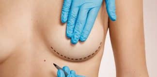 reconstrução das mamas nova tecnologia