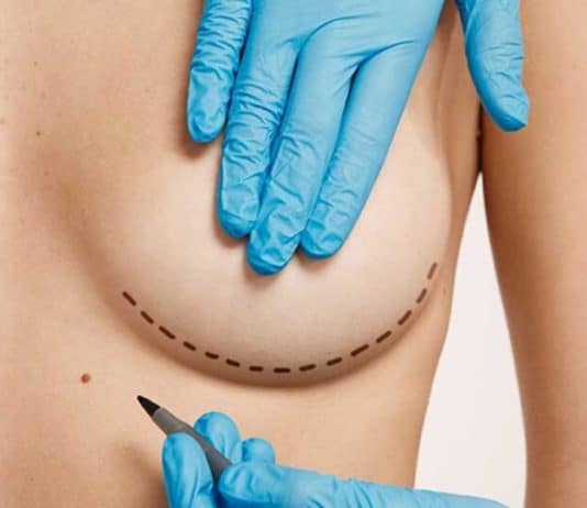 reconstrução das mamas nova tecnologia