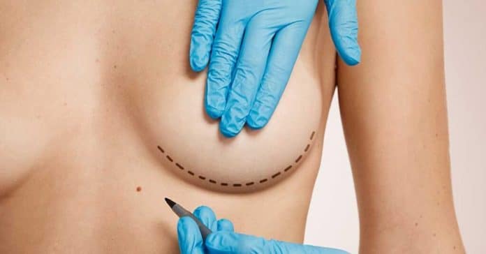 reconstrução das mamas nova tecnologia Menos cortes, menos cicatriz: Nova tecnologia cria implante injetável para reconstrução das mamas após mastectomia